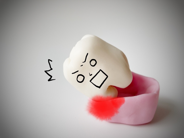 歯周病の重症度が高まることによるリスク