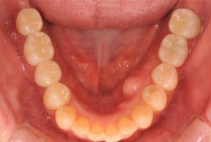 クリスタル歯科