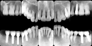 クリスタル歯科