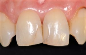 クリスタル歯科