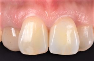 クリスタル歯科