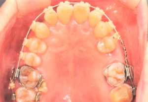 クリスタル歯科