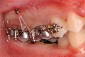 クリスタル歯科