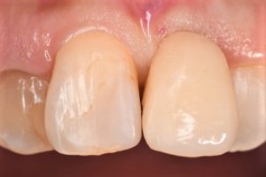 クリスタル歯科