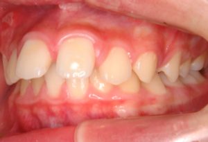 クリスタル歯科