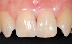 クリスタル歯科