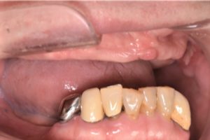 クリスタル歯科