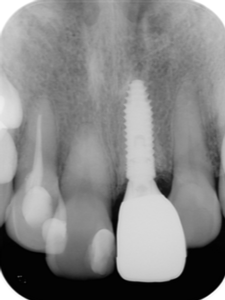 クリスタル歯科