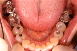 クリスタル歯科