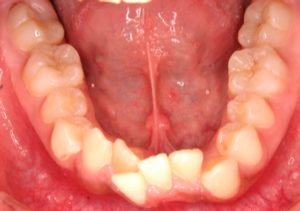 クリスタル歯科