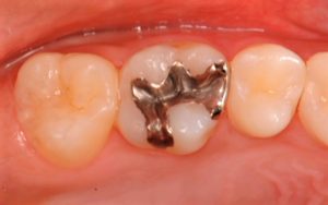 クリスタル歯科