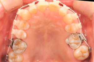 クリスタル歯科