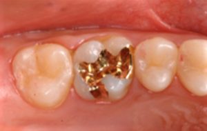 クリスタル歯科