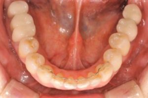 クリスタル歯科