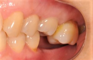 クリスタル歯科