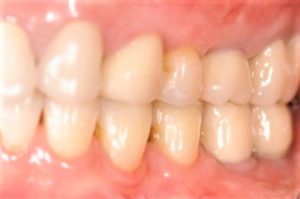 クリスタル歯科