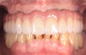 クリスタル歯科