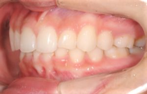 クリスタル歯科