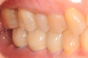 クリスタル歯科