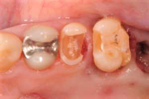 クリスタル歯科