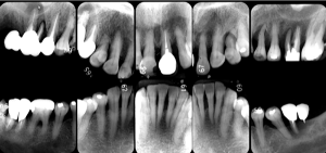 クリスタル歯科