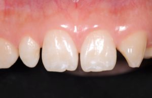 クリスタル歯科