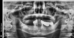 クリスタル歯科