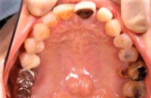 クリスタル歯科