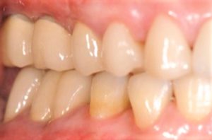 クリスタル歯科