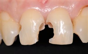 クリスタル歯科