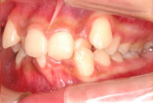 クリスタル歯科