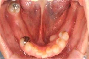 クリスタル歯科