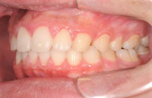 クリスタル歯科