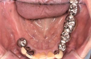 クリスタル歯科