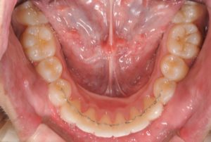 クリスタル歯科