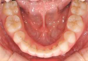 クリスタル歯科