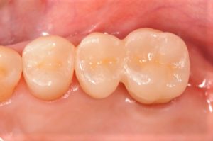 クリスタル歯科