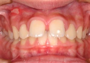 クリスタル歯科