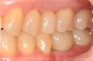 クリスタル歯科