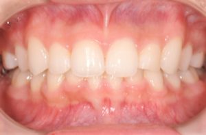 クリスタル歯科