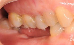 クリスタル歯科