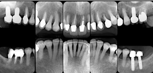 クリスタル歯科
