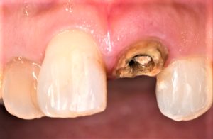 クリスタル歯科