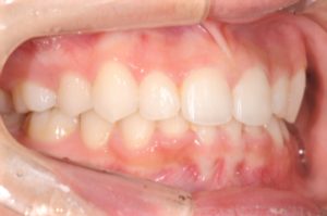 クリスタル歯科