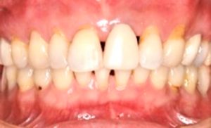 クリスタル歯科