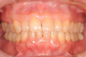 クリスタル歯科