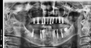 クリスタル歯科