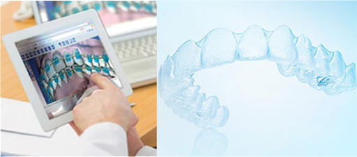 プレミアスマイル長崎矯正歯科