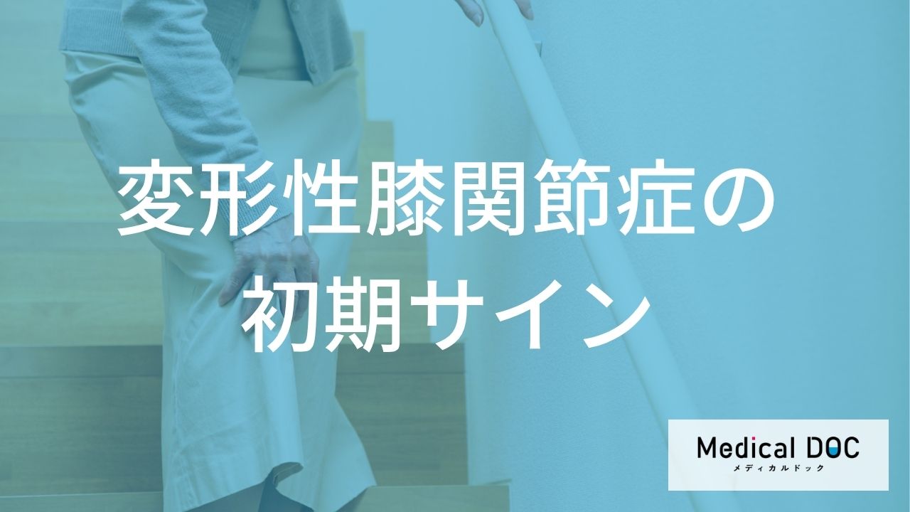 朝の「膝の動かしにくさ」は放置NG？悪化を防ぐ変形性膝関節症の初期症状