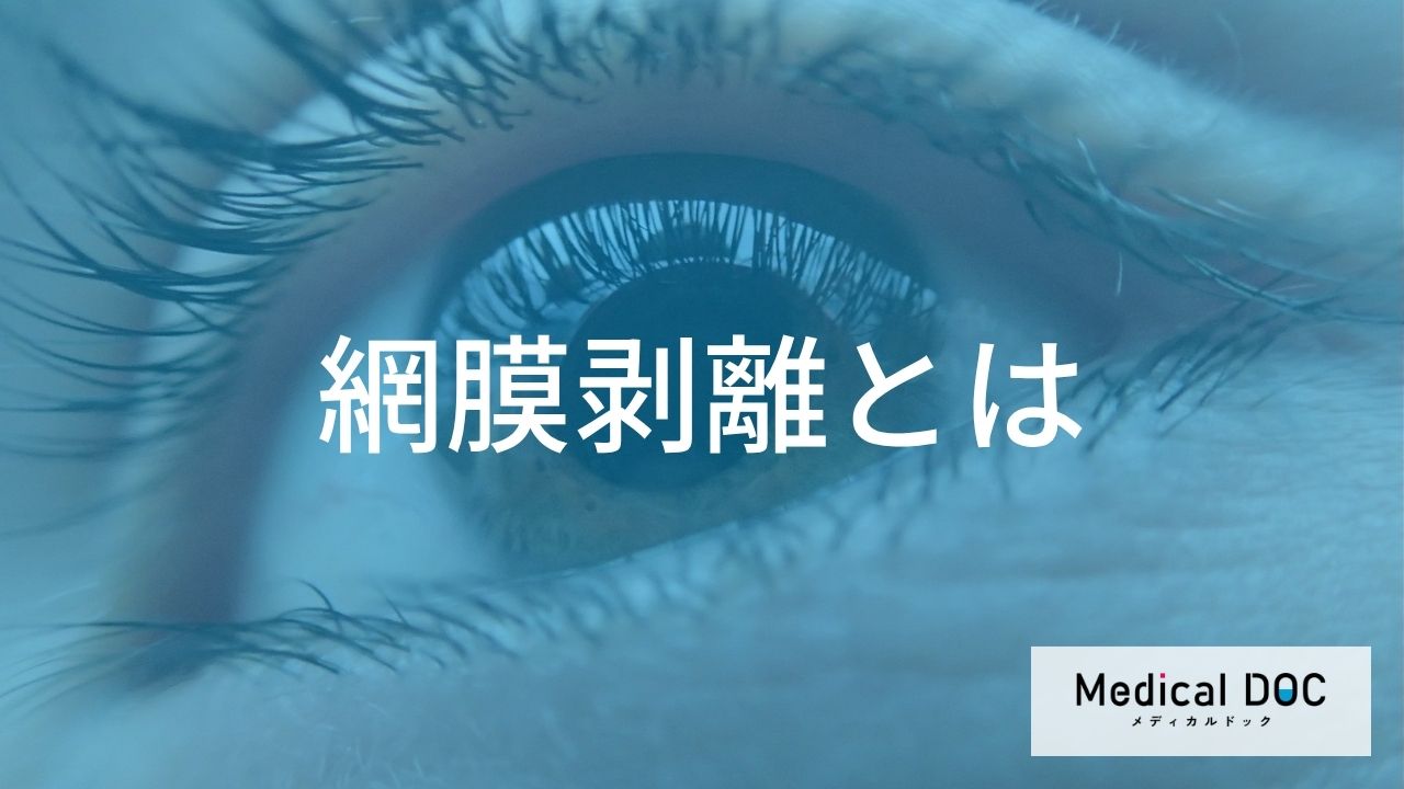 強度近視や50代以降は要注意! 「網膜剥離」になりやすい人の共通点とは?